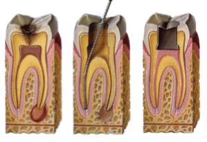 inside tooth nu smile dental
